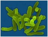 Shigella. Shigella.